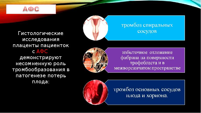 Антифосфолипидный синдром при беременности презентация