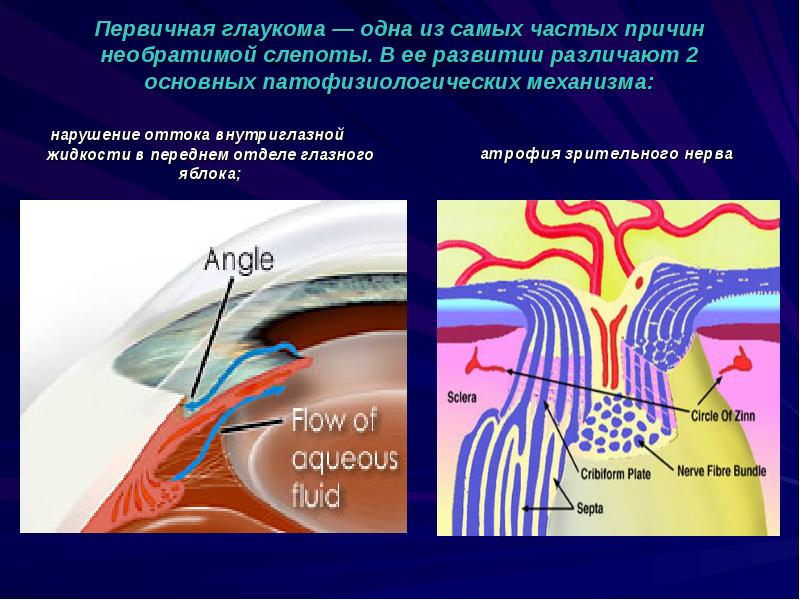 Темы для презентаций на тему глаукома