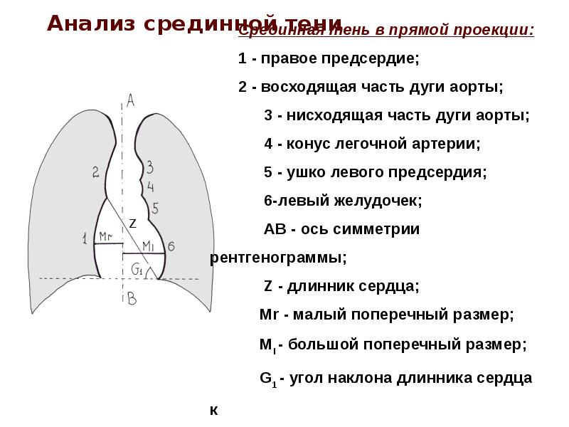 Схема описания рентгенограммы легких