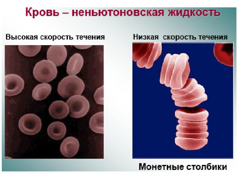 Реология крови презентация