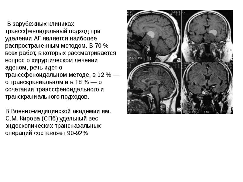 Опухоли головного и спинного мозга презентация