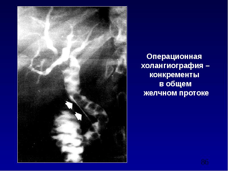 Лучевая диагностика брюшной полости презентация