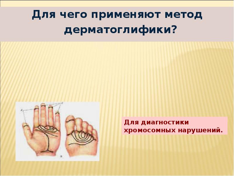Для чего применяют метод дерматоглифики?
Для чего применяют метод дерматоглифики? Для чего применяют метод дерматоглифики?
Для чего применяют метод дерматоглифики?