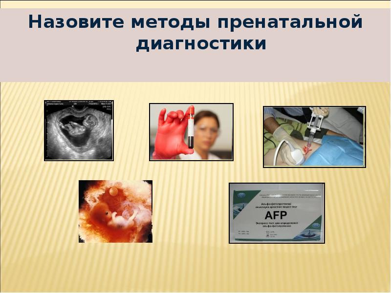 Назовите методы пренатальной диагностики
Назовите методы пренатальной диагностики Назовите методы пренатальной диагностики
Назовите методы пренатальной диагностики