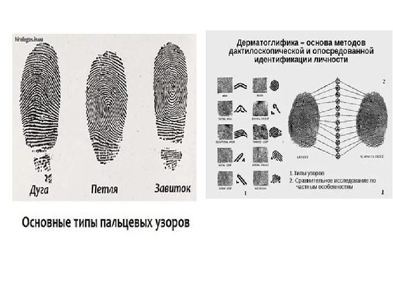 Метод дерматоглифики в генетике презентация