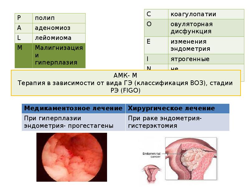 Аномальные маточные кровотечения презентация