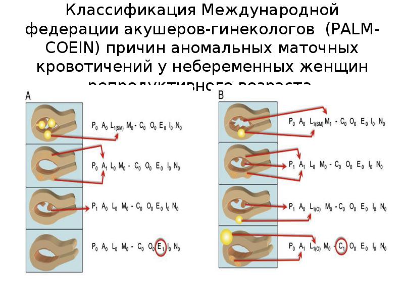 Аномальные маточные кровотечения презентация