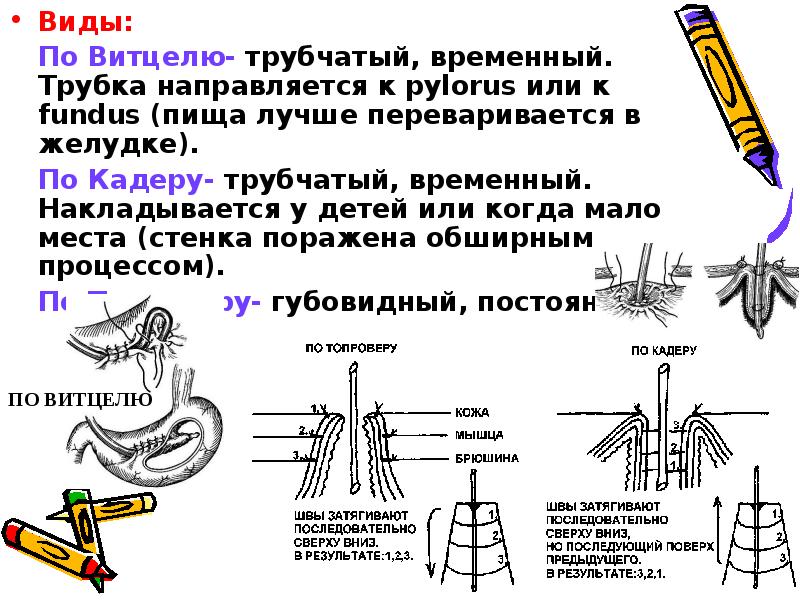 Сосудистый шов топографическая анатомия презентация