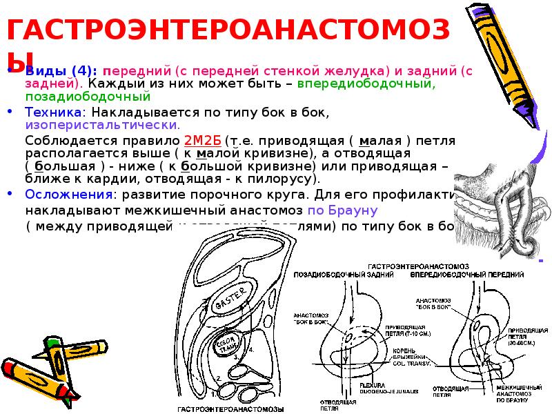 Анастомоз по брауну схема