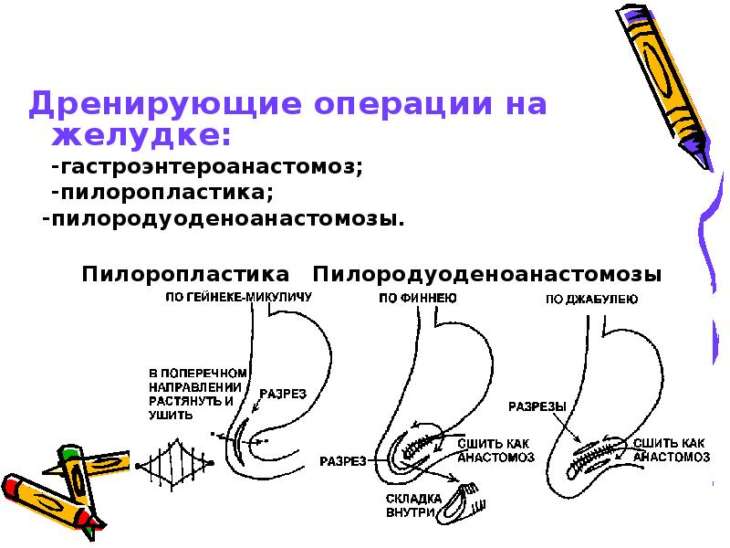 Бвк 322 схема подключения