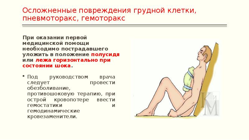 Травмы груди презентация