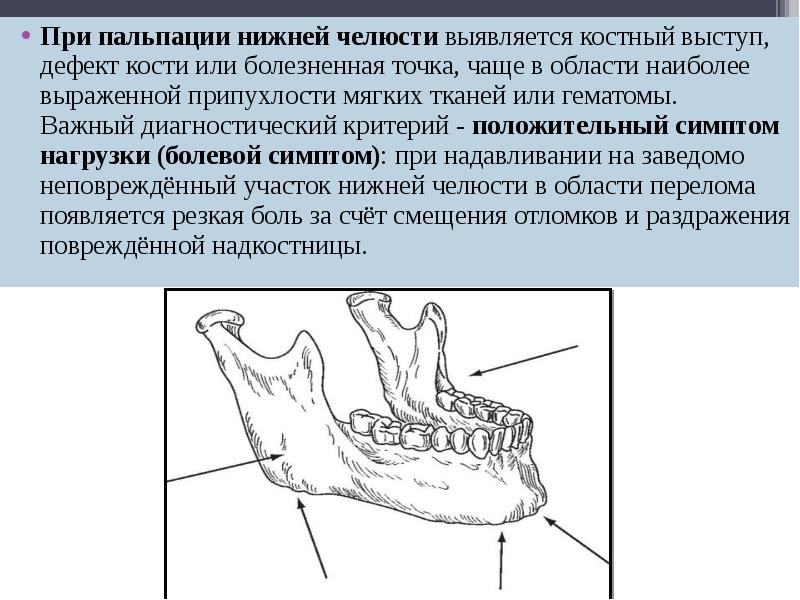 Перелом нижней челюсти карта вызова