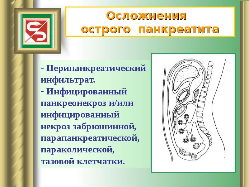 Осложнения острого панкреатита презентация