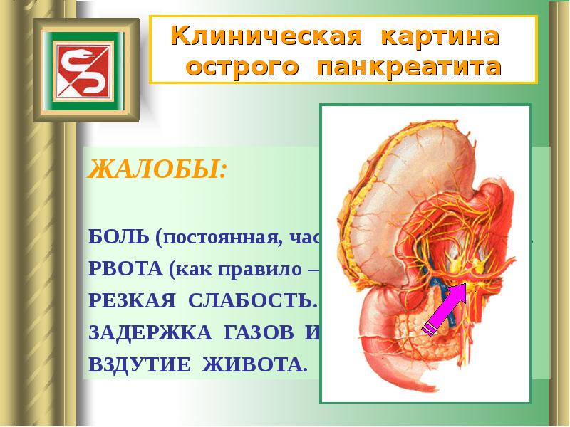 Презентация на тему острый панкреатит