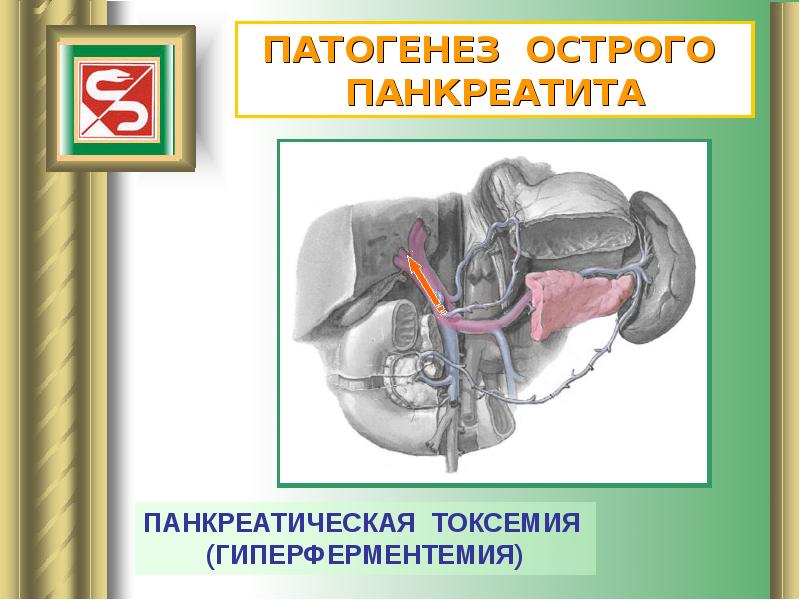 Острый панкреатит презентация хирургия