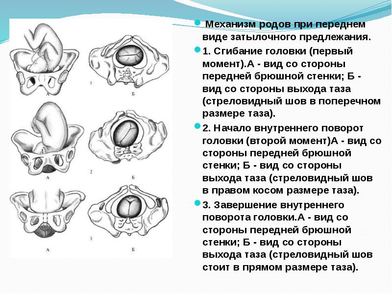 Биомеханизм родов при переднем виде затылочного предлежания презентация