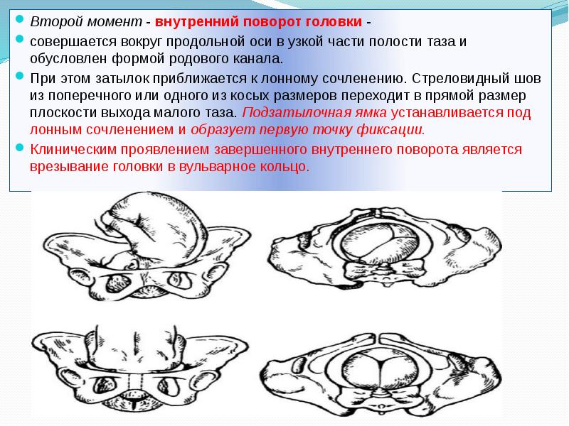 Презентация биомеханизм родов при переднем и заднем виде затылочного предлежания