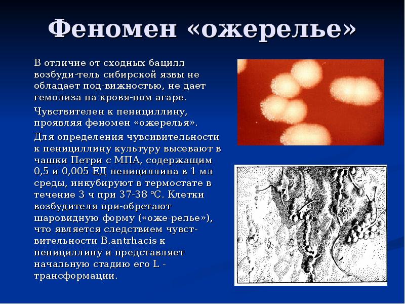 Феномен «ожерелье» 	В отличие от сходных бацилл возбуди-тель сибирской язвы не