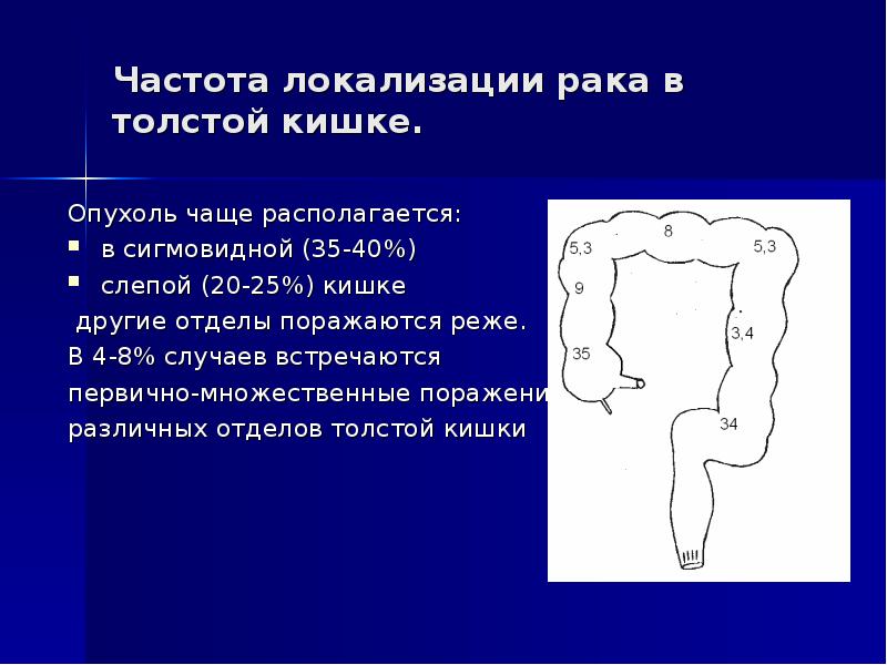 Наиболее частой локализацией. Опухоль толстой кишки локализации. Локализация слепой кишки. Локализация Толстого кишечника. Локализация сигмовидной кишки.