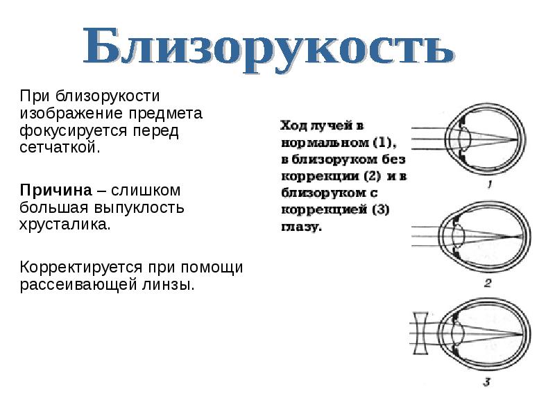 Изображения предметов фокусируются