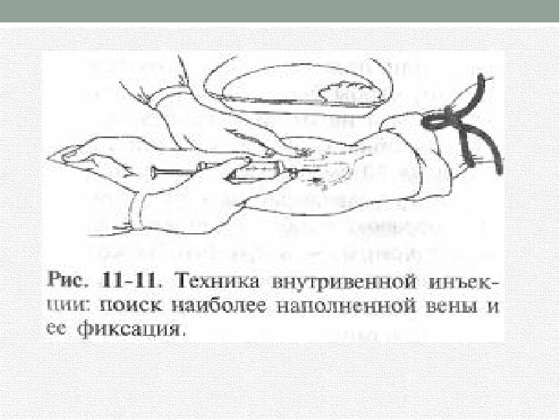 Заполнение внутривенной системы алгоритм. Техника внутривенной инъекции. Внутривенное Введение алгоритм манипуляции. Схема выполнения внутривенной инъекции. Внутривенные струйные инъекции алгоритм.