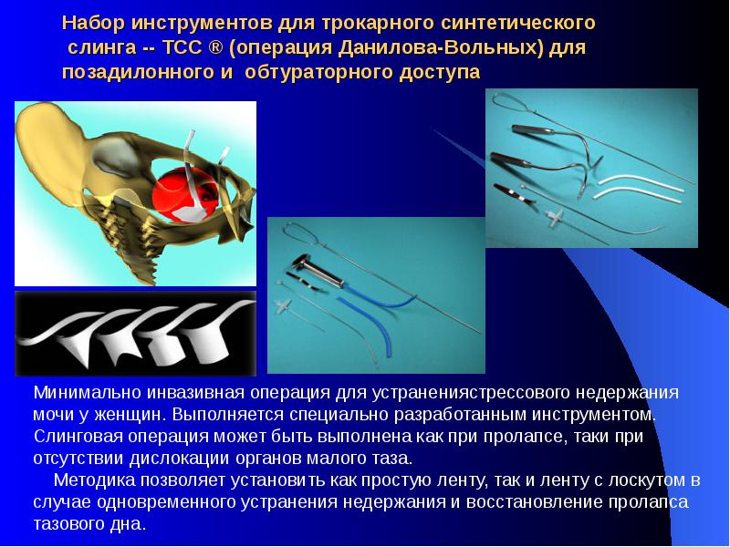 Минимально инвазивных. Инструменты для минимально инвазивной хирургии. Инвазивное вмешательство это. Минимальная инвазивная хирургия.