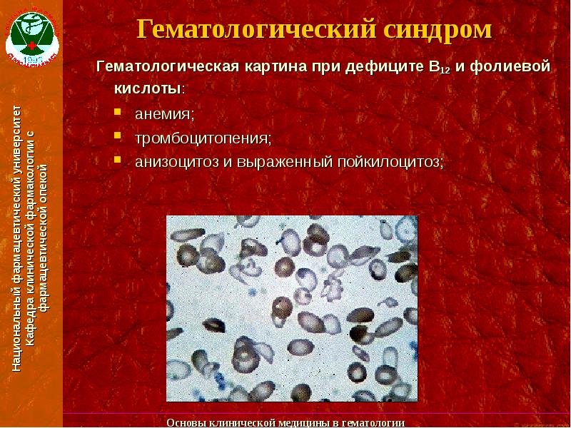 Презентации по гематологии