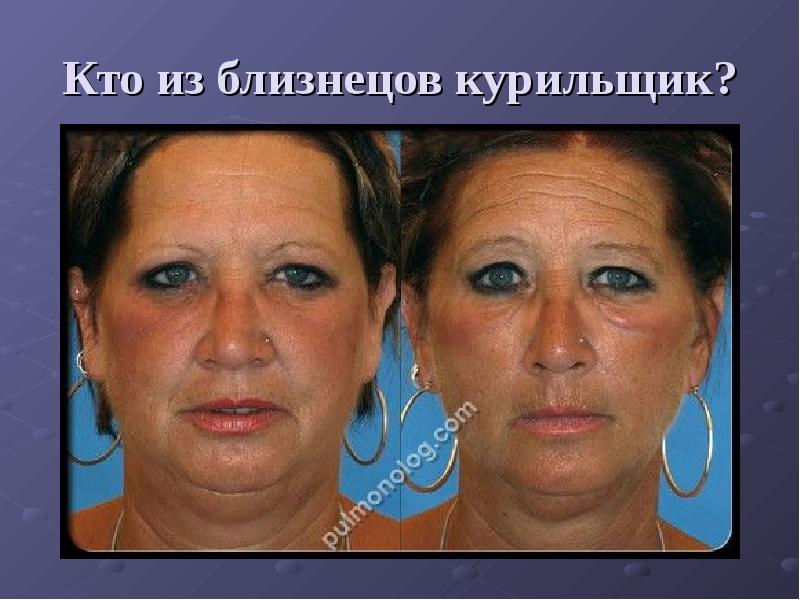 Как меняется лицо когда бросаешь курить фото до и после