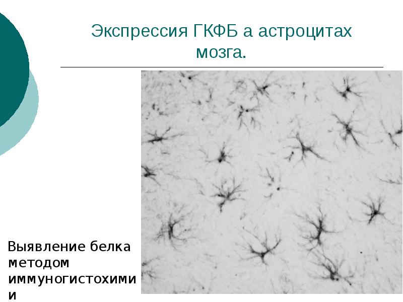 Астроциты мозга. Способ распознавания белка. Астроциты. Астроцитарная глия. Работа астроцитарной глии.
