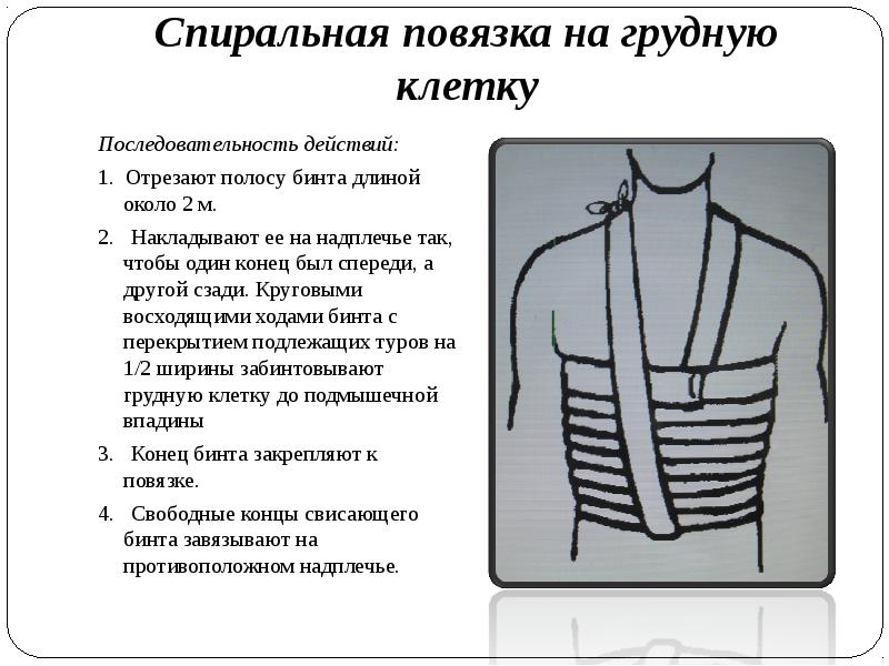 Спиральная повязка. Техника наложения спиральной повязки на грудную клетку. Ширина бинта при наложении повязки на грудную клетку:. Десмургия спиральная повязка на грудную клетку. Спиральная повязка на грудную клетку алгоритм.