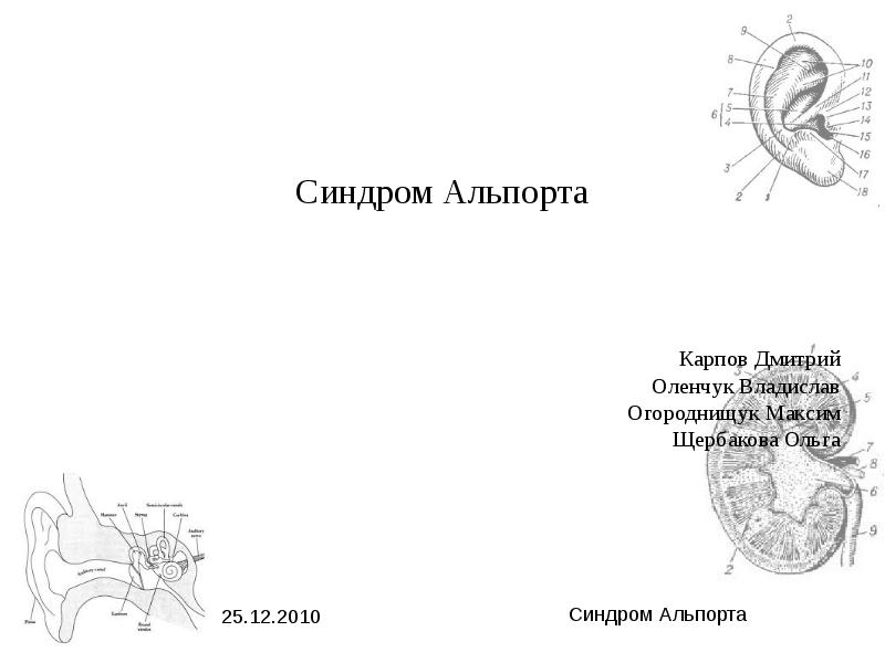 Синдром альпорта презентация