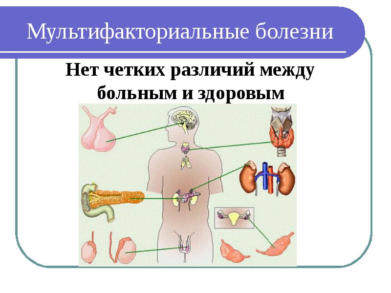 Мультифакториальные заболевания. Мультифакторные наследственные заболевания. Мультифакторные болезни наследственные человека. Пример мультифакториального заболевания. Мультифакторные заболевания презентация.