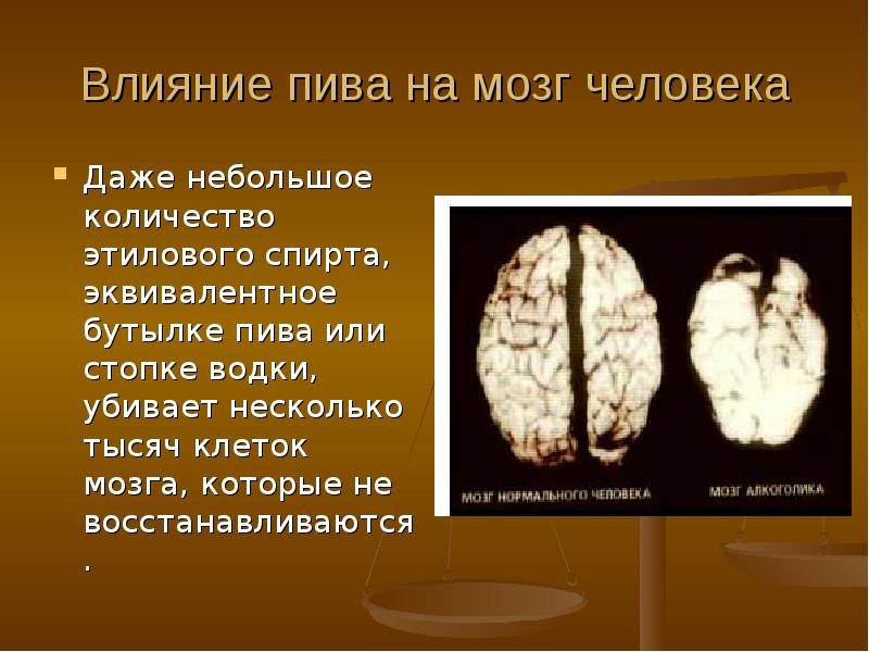 Головной мозг пьющего. Влияние пива на мозг человека. Влияние этанола на мозг человека. Влияние этилового спирта на мозг.