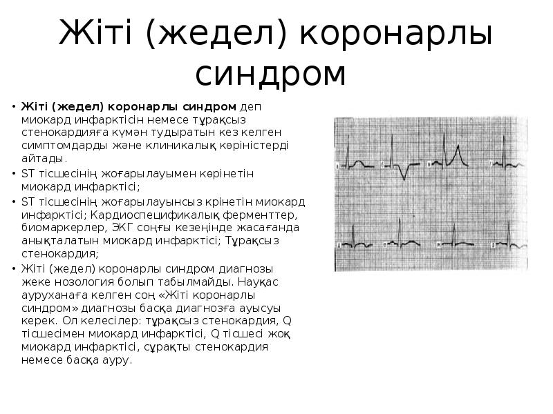 Жедел коронарлы синдром презентация