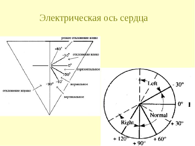 Ось сердца горизонтально что это значит