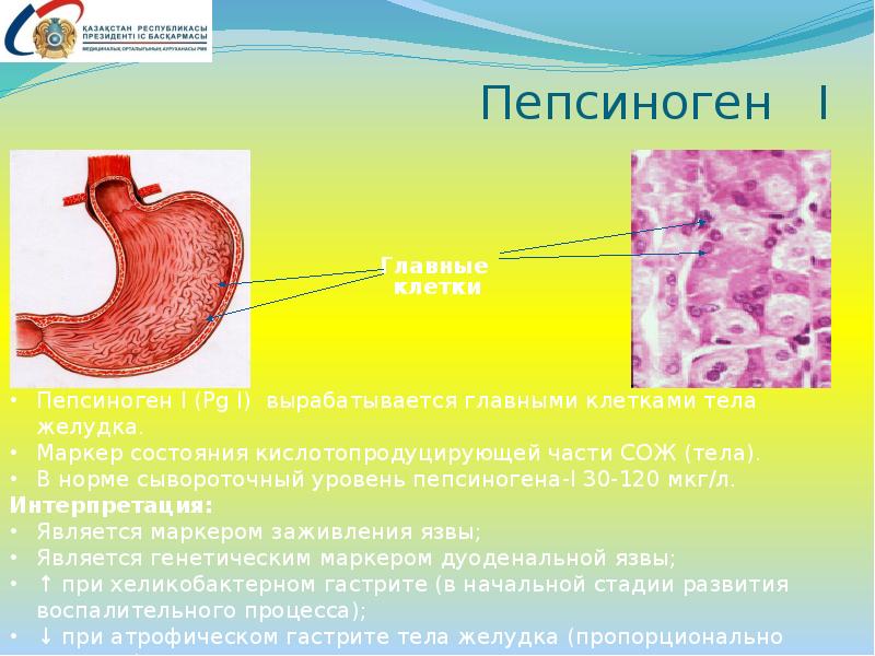 Предраковые заболевания желудка