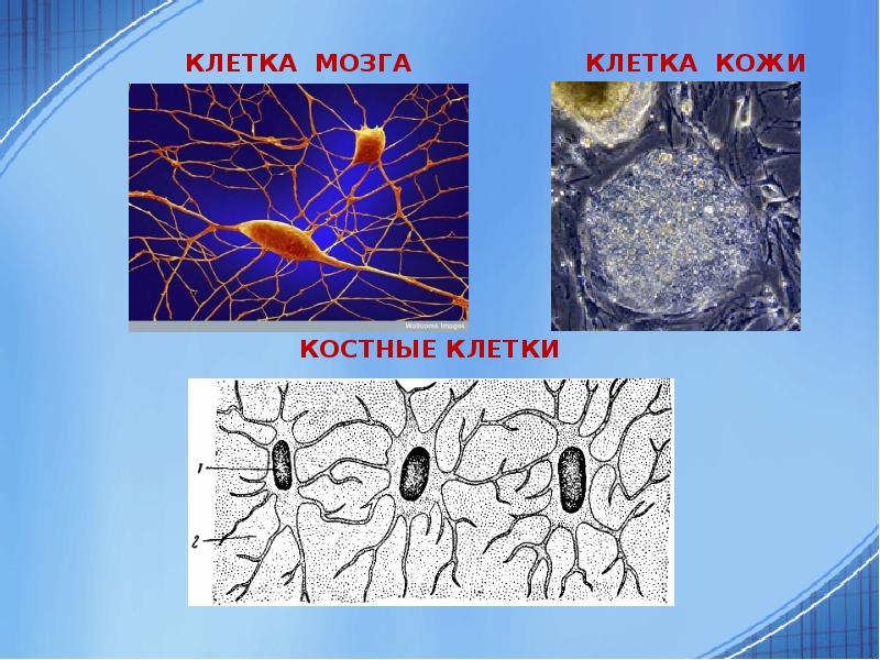 Клетки костной ткани. Костные клетки. Из клеток кожи в клетки мозга. Найдите костные клетки. Скелетные клетки.