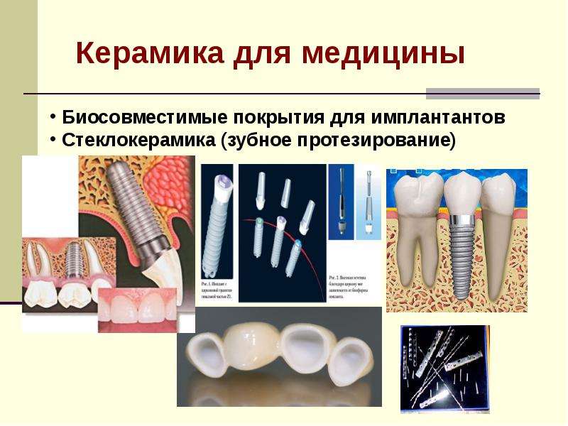 Современные материалы в стоматологии презентация