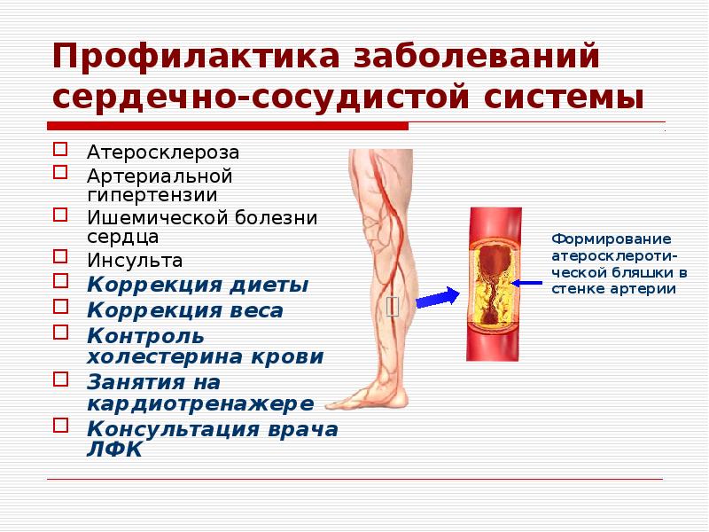 Ишемические гипертензии