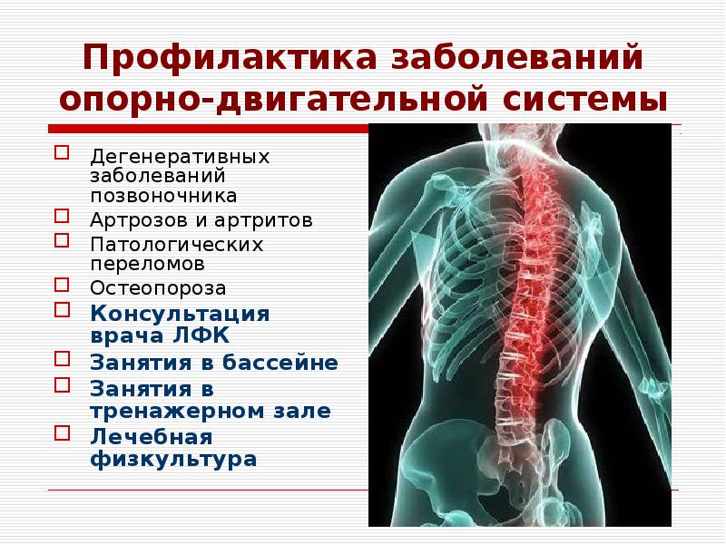 Нарушение опорно двигательного аппарата. Профилактика травм опорно-двигательного аппарата памятка. Памятка по профилактике заболеваний опорно-двигательного аппарата. Памятка профилактика опорно двигательного аппарата. Профилактика опорно двигательной системы памятка.