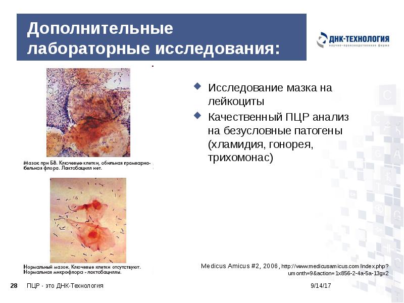 Дополнительные лабораторные исследования:
Medicus Amicus #2, 2006, http://www.medicusamicus.com/index.php?umonth=9&action=1x856-2-4a-5a-13gx2 Дополнительные лабораторные исследования:
Medicus Amicus #2, 2006, http://www.medicusamicus.com/index.php?umonth=9&action=1x856-2-4a-5a-13gx2