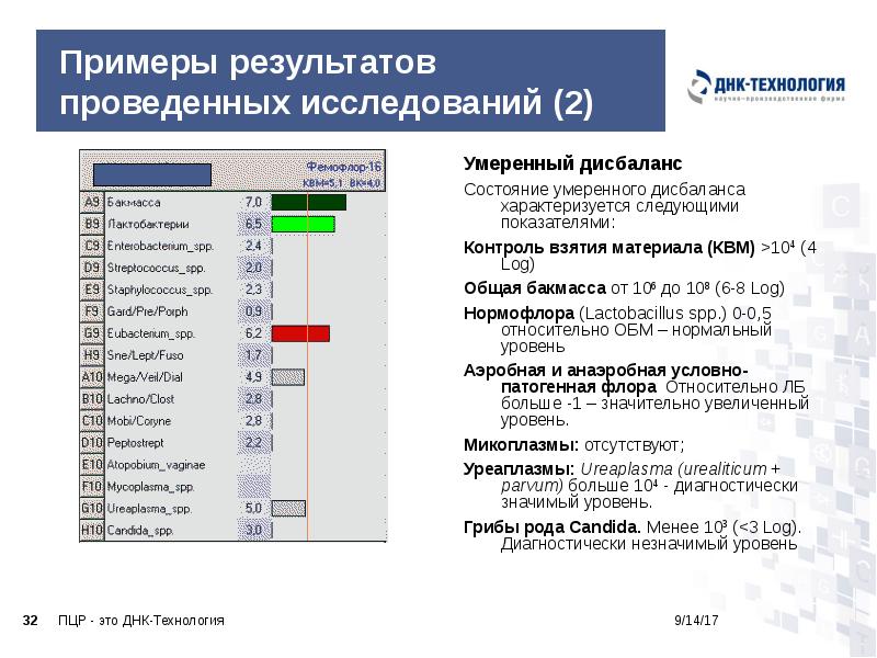 Примеры результатов проведенных исследований (2)
Умеренный дисбаланс
Состояние умеренного дисбаланса характеризуется Примеры результатов проведенных исследований (2)
Умеренный дисбаланс
Состояние умеренного дисбаланса характеризуется