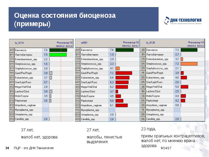 Оценка состояния биоценоза (примеры) Оценка состояния биоценоза (примеры)