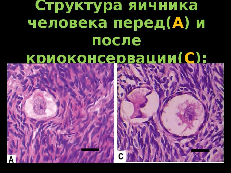 Яичник структурный. Криоконсервация яичника. Криоконсервация ткани яичка. Криоконсервация овариальной ткани.