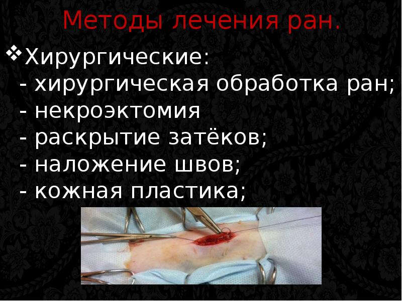 Раны хирургия презентация