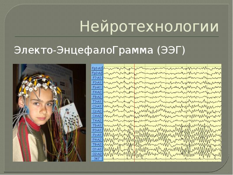 Нейротехнологии. Нейротехнологии презентация. Нейротехнологии перспективы. Пример нейротехнологий. Моделирование энцефалограммы.