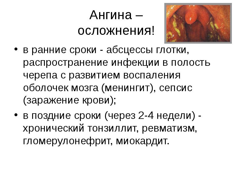 Осложнения ангины