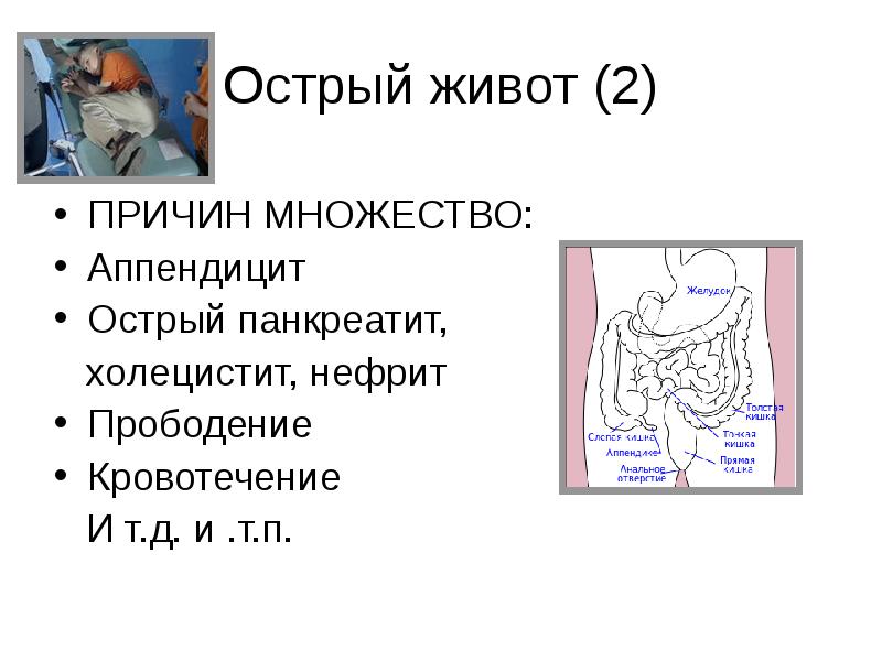 Острый живот причины