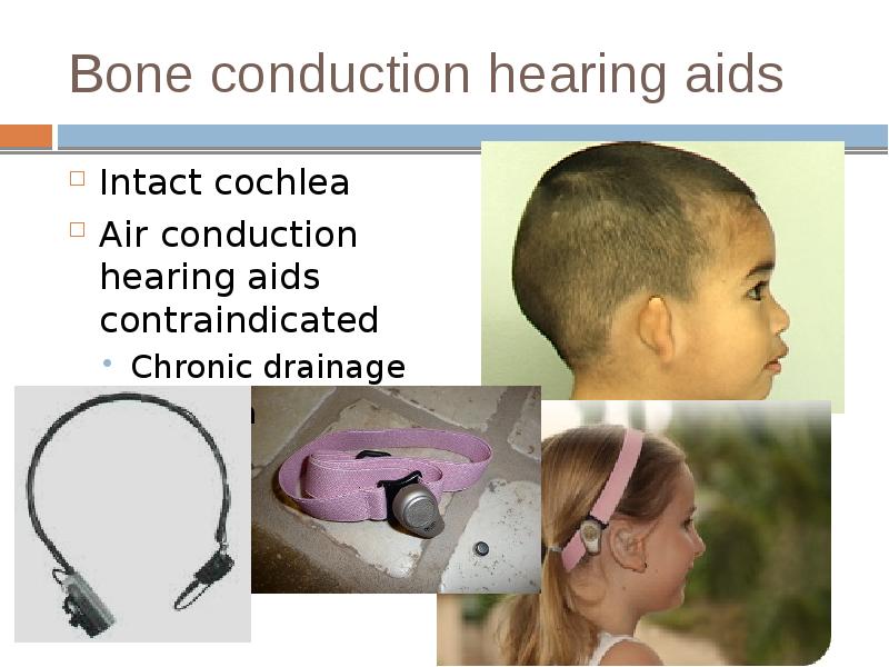 Bone conduction hearing aids
Intact cochlea
Air conduction hearing aids contraindicated
Bone conduction hearing aids
Intact cochlea
Air conduction hearing aids contraindicated