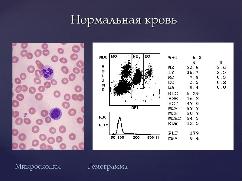 Гемограмма. Микроскопия крови. Лейкоцитарная формула крови микроскопия. Общий анализ крови микроскопия. Микроскопия кровикрови.
